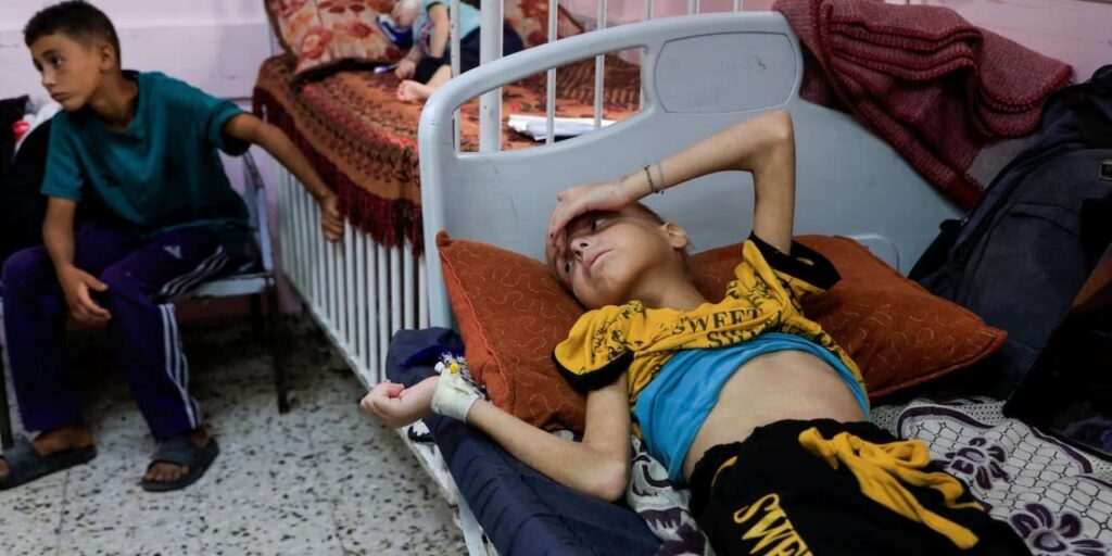 gazzede israil saldirisi sonrasi nasir hastanesini kanalizasyon basti TgMSIm7B